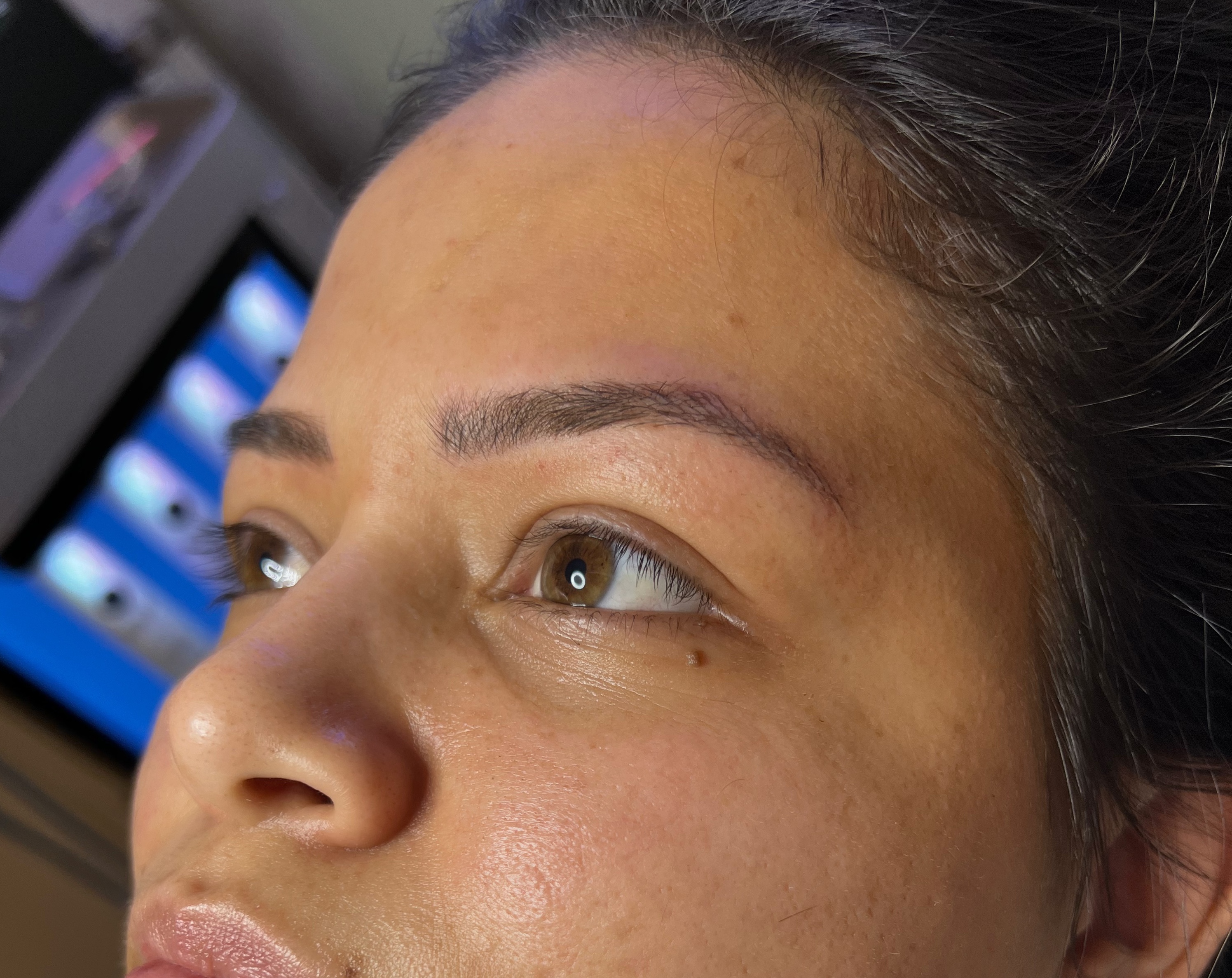 After Microblading - Case 1