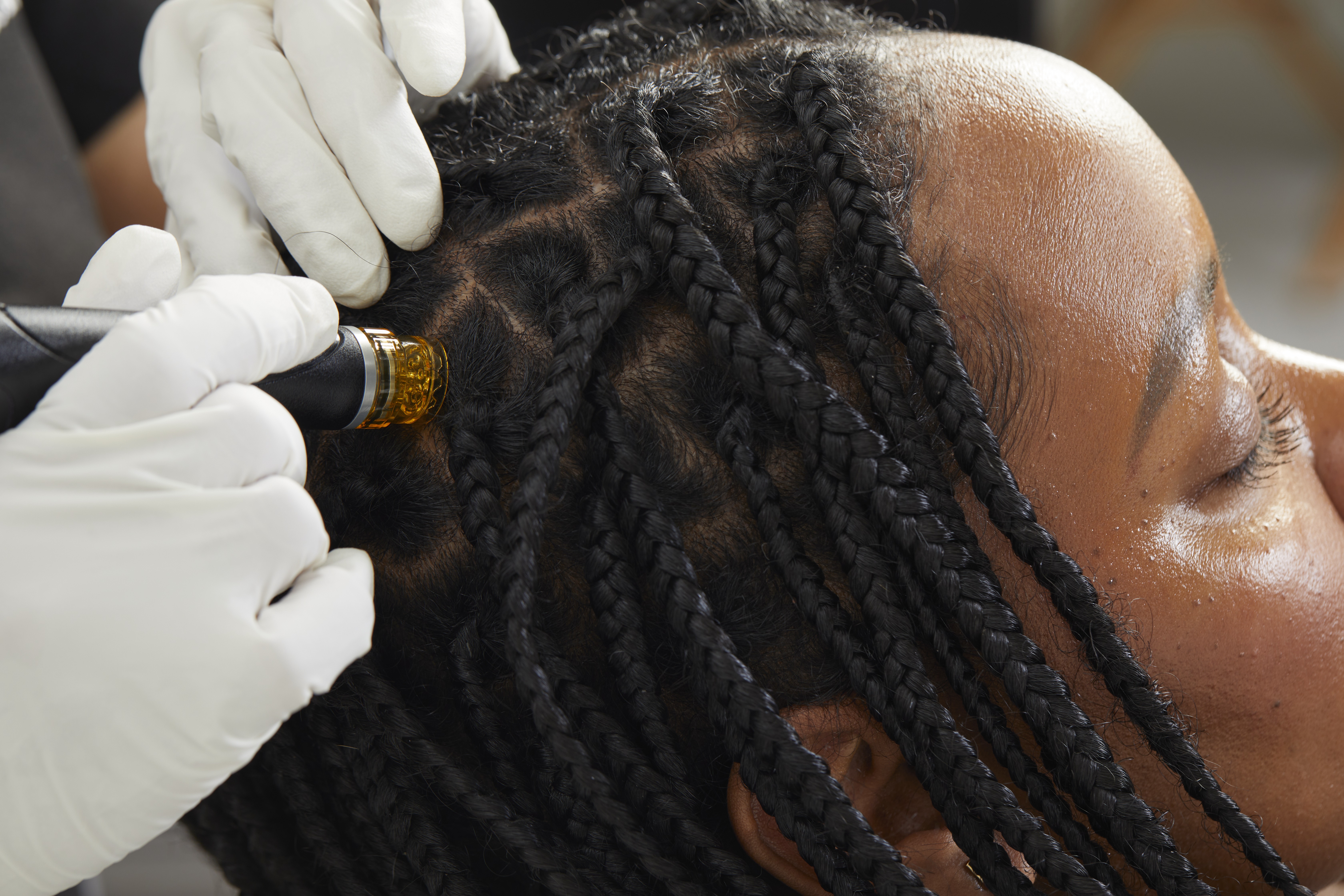 Hydrafacial® Scalp Glow